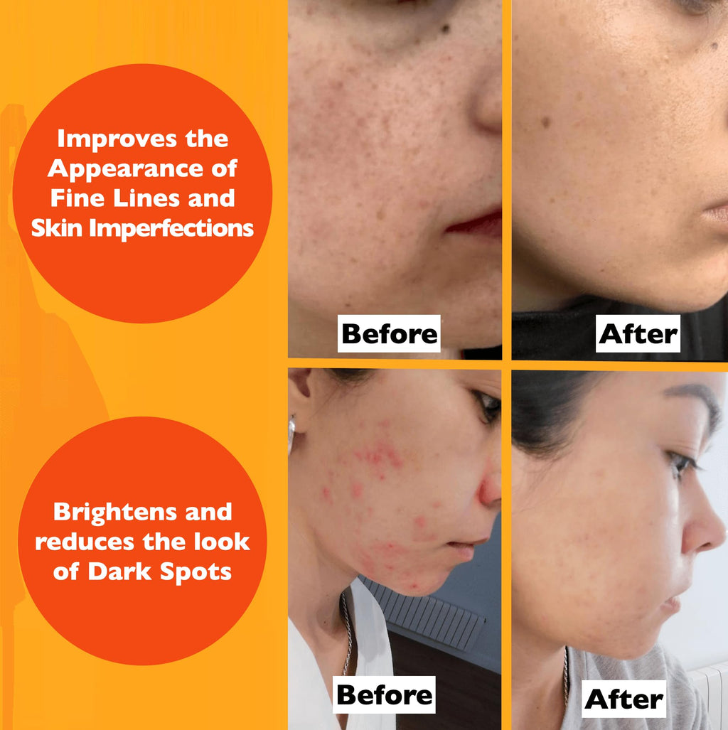 Vitamin C Serum For Face – Anti Aging Face Serum with Vitamin C, Hyaluronic Acid, Vitamin E. Brightening Formula. Improve Appearance of Dark Spots, Tone, Fine Lines & Wrinkles, Glowing Skin 2 Fl Oz by Trenches of Mariana