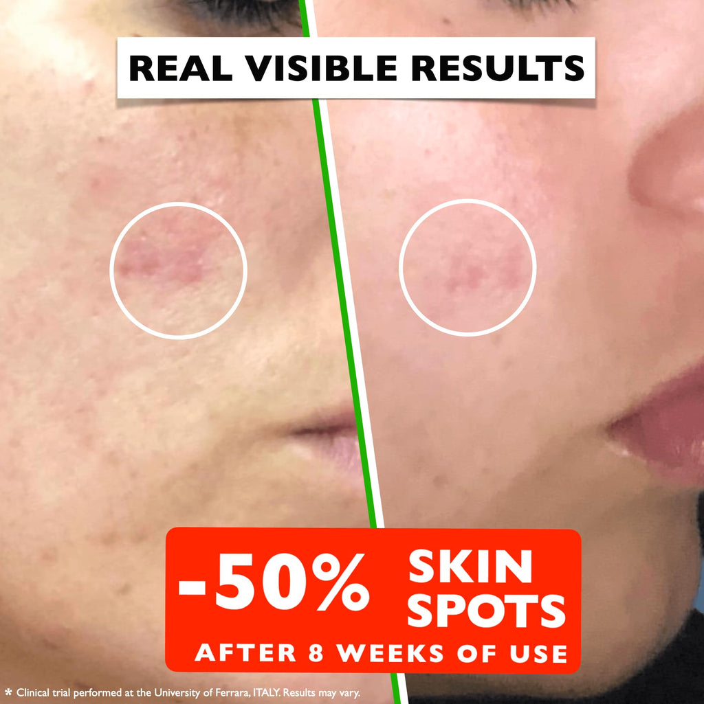Vitamin C Serum For Face – Anti Aging Face Serum with Vitamin C, Hyaluronic Acid, Vitamin E. Brightening Formula. Improve Appearance of Dark Spots, Tone, Fine Lines & Wrinkles, Glowing Skin 2 Fl Oz by Trenches of Mariana