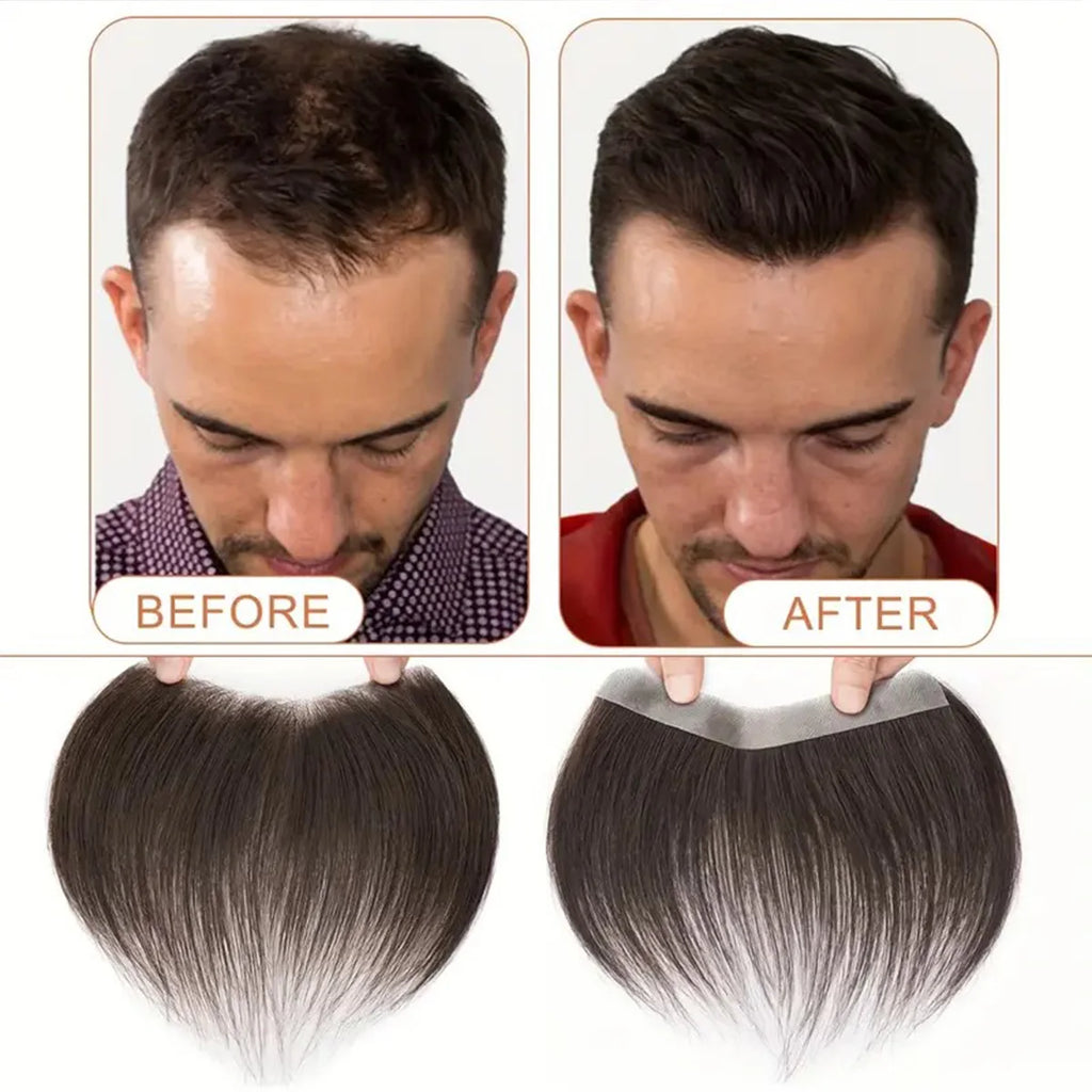 6 Inch Seamless Hairline Topper, Natural Look Replacement for Forehead Fringe & Hairline, Invisible Edge Adhesive Hair Extension